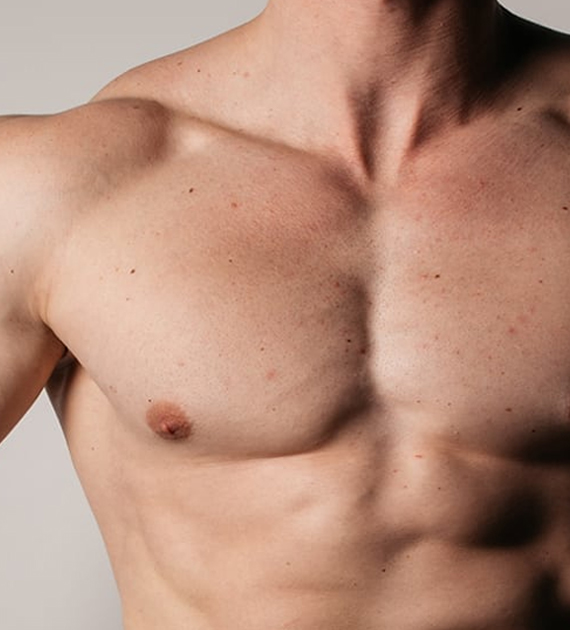 Gynecomastia Consultation Image